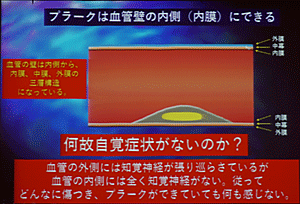 講演会の様子